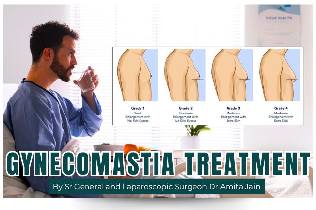 Leading Surgeon for Gynecomastia Dr Amita Jain Leading Surgeon for Gynecomastia Dr Amita Jain